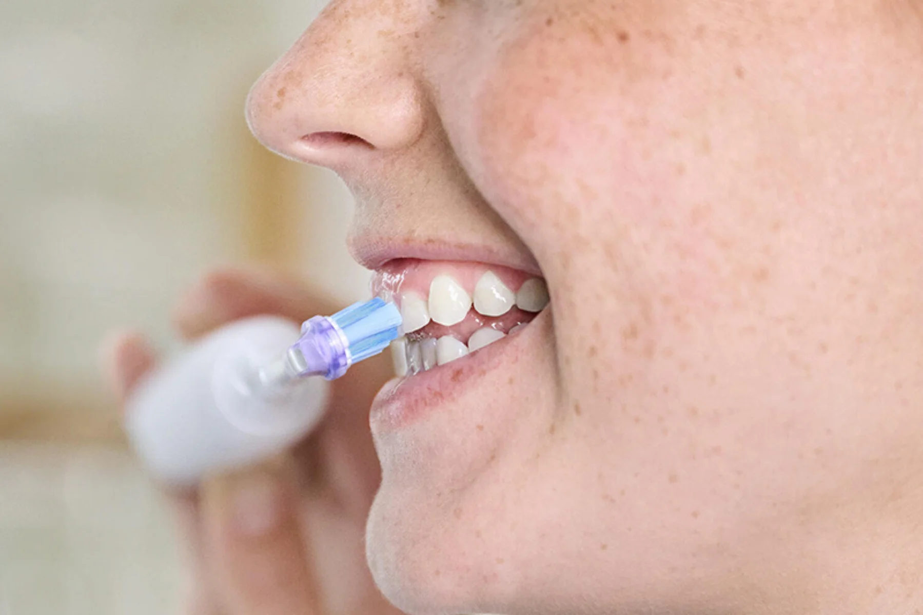 Náhradná hlavica kefky PHILIPS HX9052/87 odstranuje zubny povlak