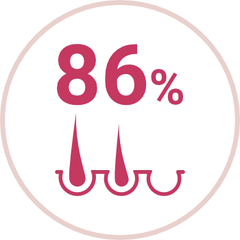 Redukcia chĺpkov Philips Lumea